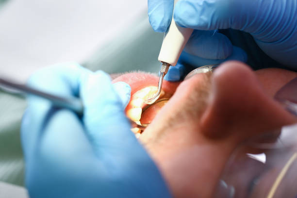 Best Orthodontic Emergency Dentist in Delavan, IL