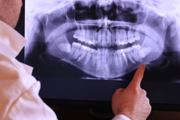 Best Holiday Emergency Dentist in Delavan, IL